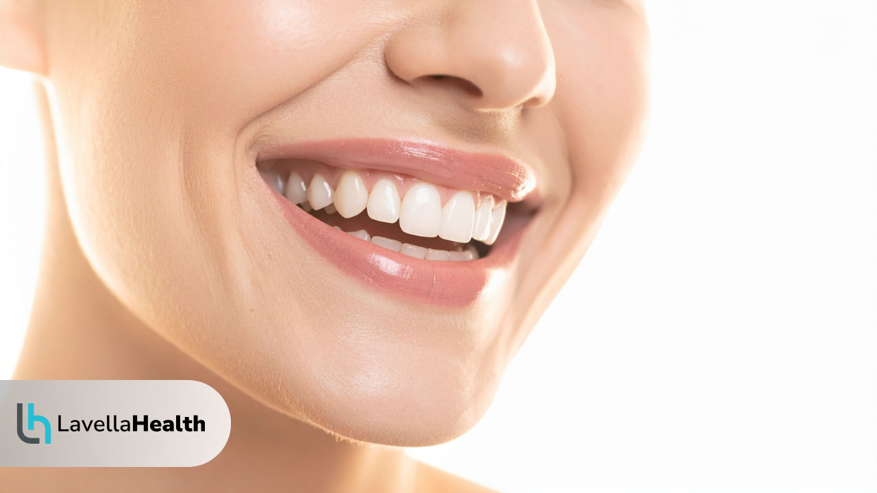 Какво представлява избелването на зъби