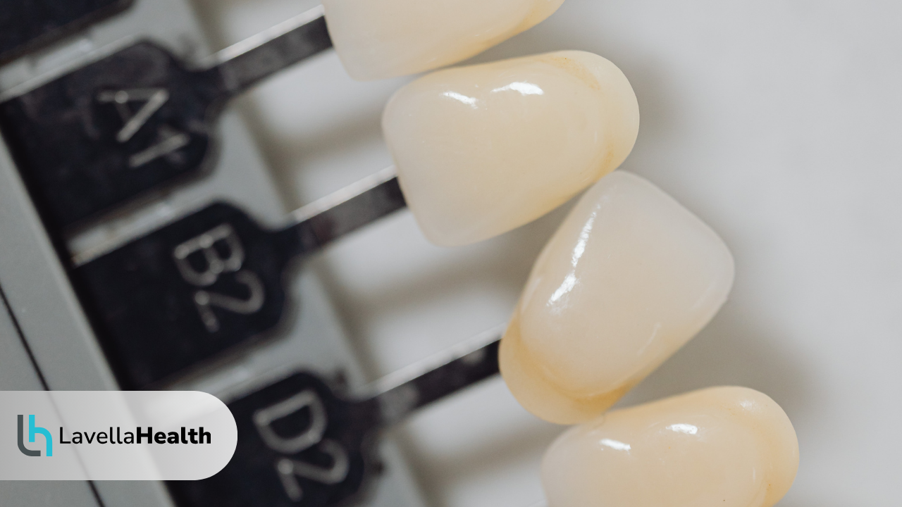 зъбна коронка