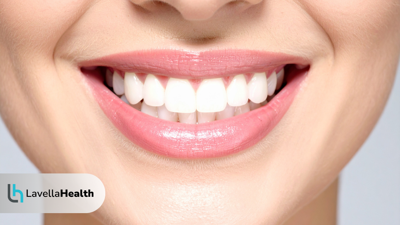 Холивудска усмивка