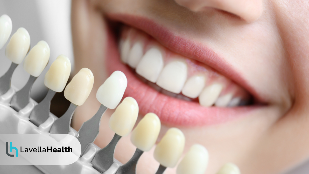 Избелване на зъбите Безопасни методи за по-сияйна усмивка