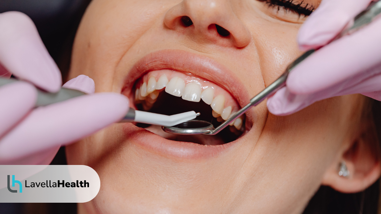 Пътят към съвършената усмивка Кое дентално лечение е правилното за вас